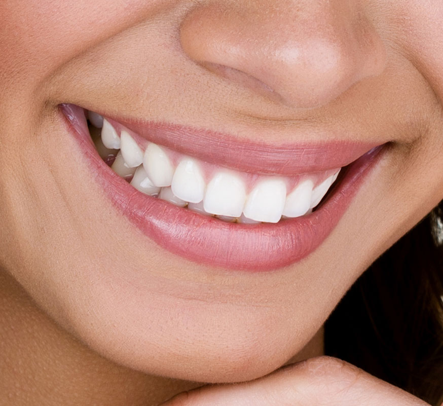 beautiful straight smile